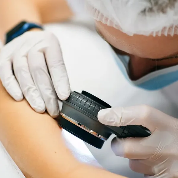 Dermatología en Huaral - Dermatólogo Especialista en Tratamientos de la Piel-1
